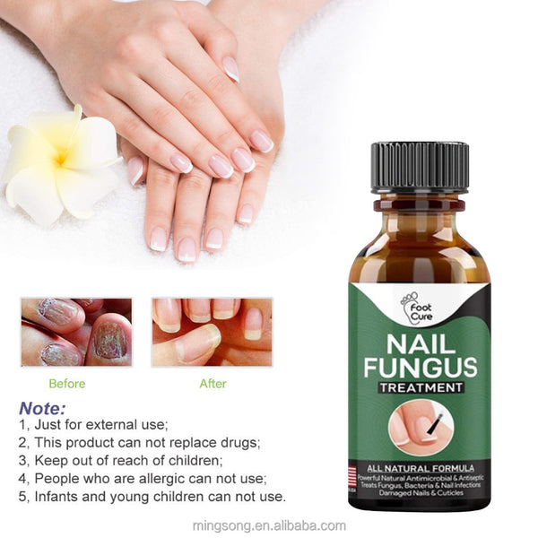 Famedeals.pk™ - Nail Fungi Treatment Serum