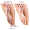 Famedeals™ - Finishing Touch Flawless Pedi Electronic Tool File and Callus Remover, Pedicure